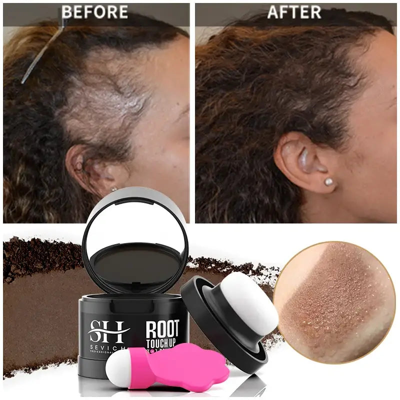 High-Quality Hairline Powder Concealer and Hair Care Products at Queen Afro